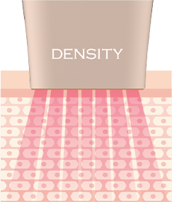 키포인트이미지